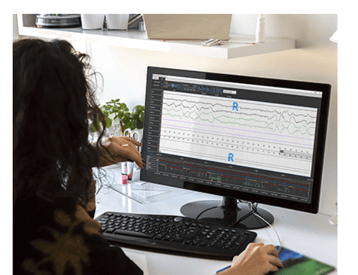 Cerebra-Sleep-System-Implements-LightningChart-Data-Visualization-XY-line-Series-charts