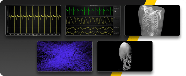 MedTech-Healthcare-Data-Visualization-By-LightningChart